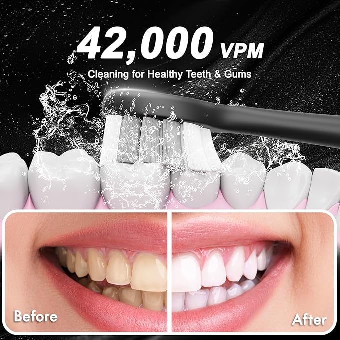 Diamond Style - Sonic Electric Toothbrush