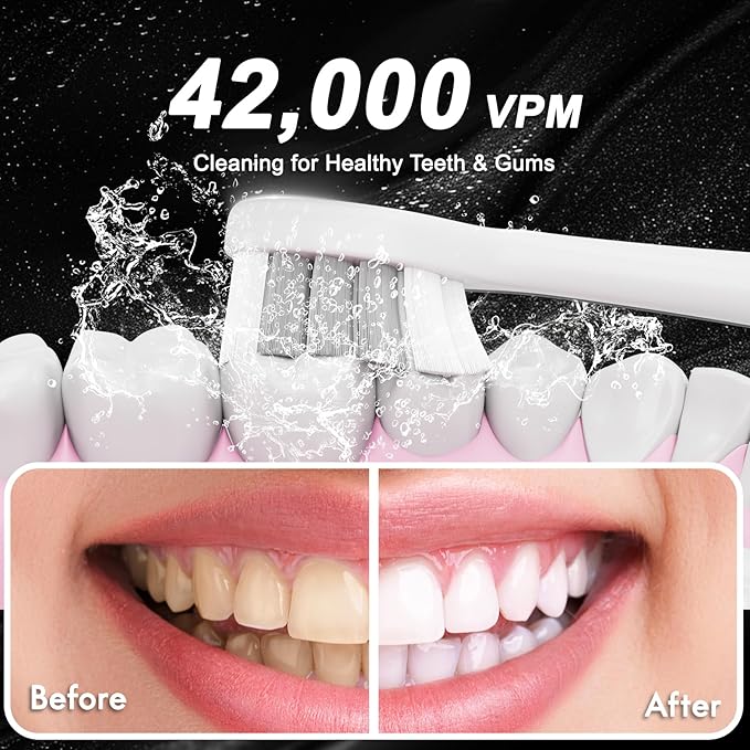 Diamond Style - Electric Toothbrush, 10 Brush Heads & Travel Case, 000 VPM